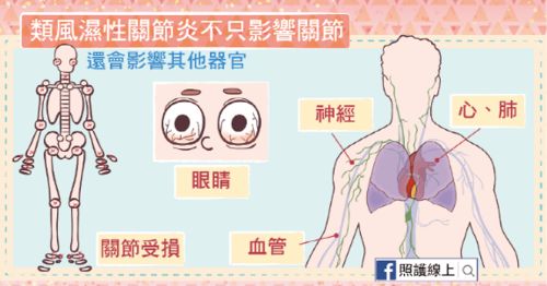 网红女校长张桂梅帮失学女生走出大山,谁又能助她走出 不死的癌症 