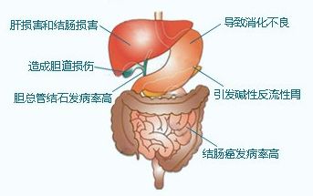 体检时发现胆结石怎么办 济南106医院专家苗庆松告诉您