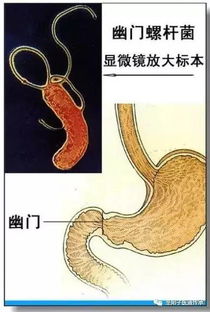 人体各部位 各器官的作用及病理分析 近100张图文 