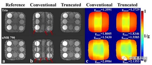 前沿科技 中科院科学家在磁共振快速三维成像研究中获进展