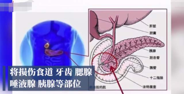 插入胃里50厘米 暴食催吐管竟公开售卖,有人差点丢掉性命